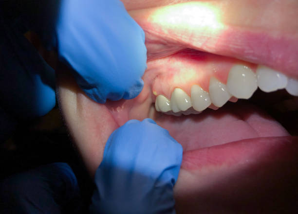 Best Broken or Cracked Tooth Emergency Dentist in , RI